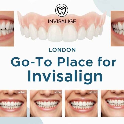 The Go-To Place for Invisalign in London